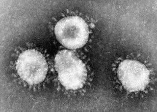 Coronavirus-Mikroskopaufnahme sw